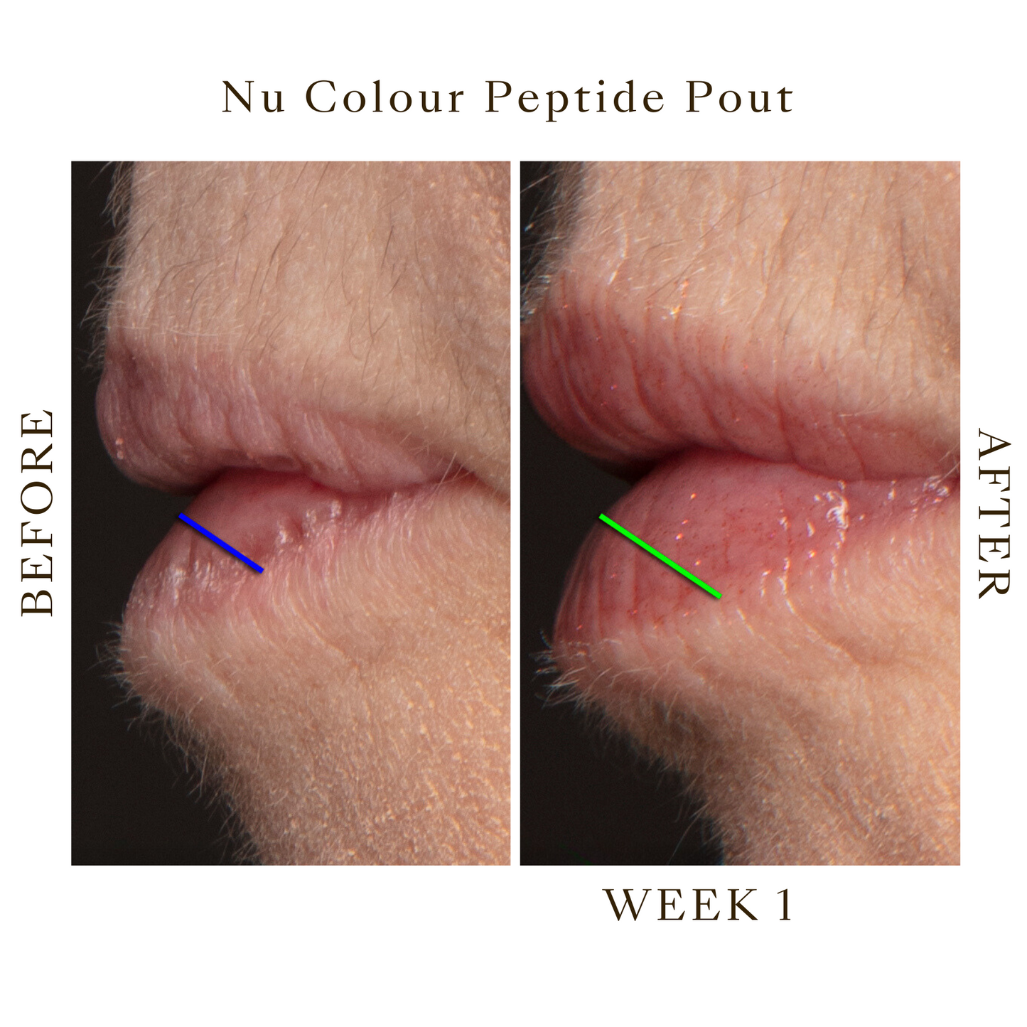 Peptide Pout