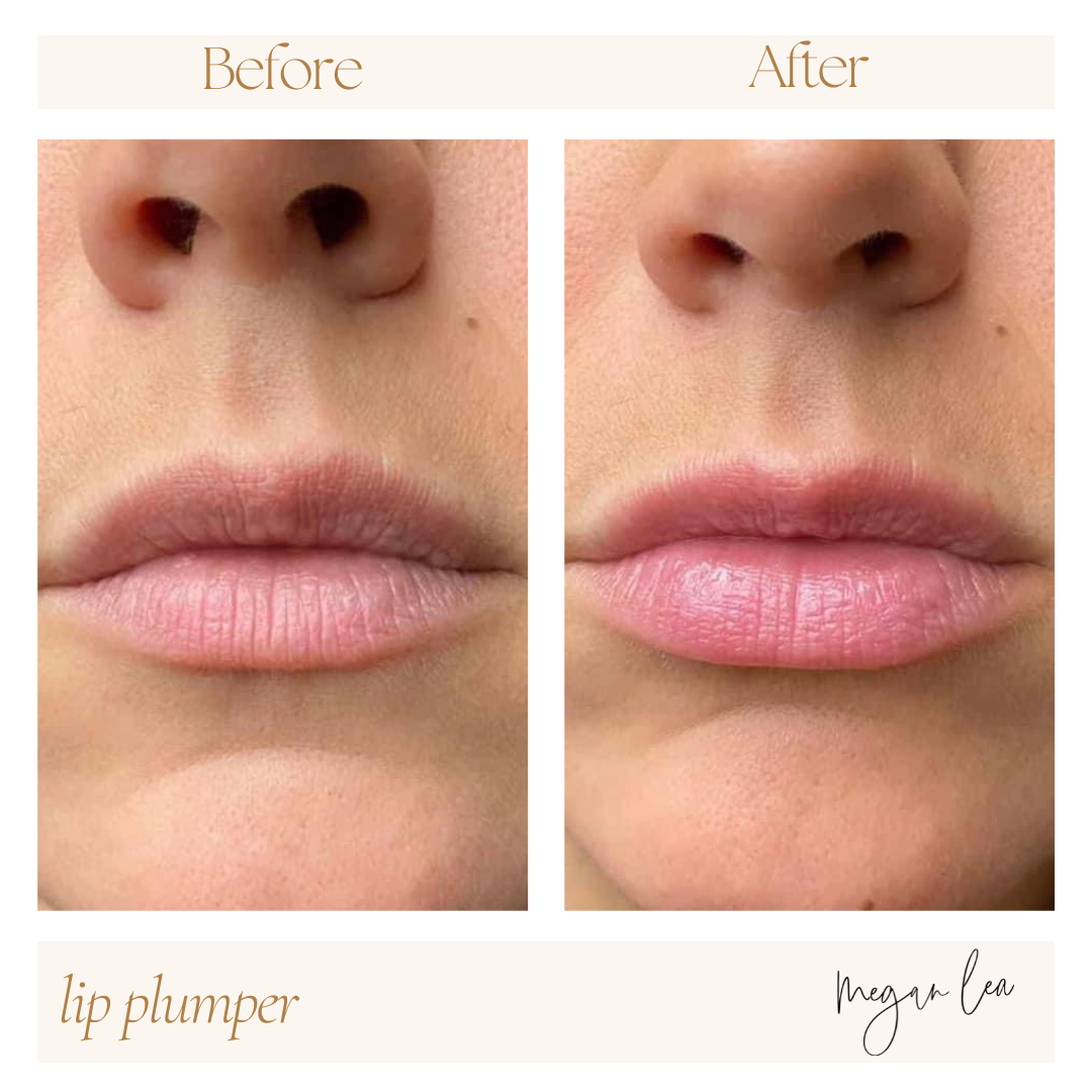 Lip Plumping Balm